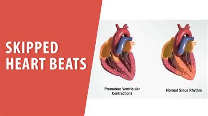 Are skipped heart beats serious?