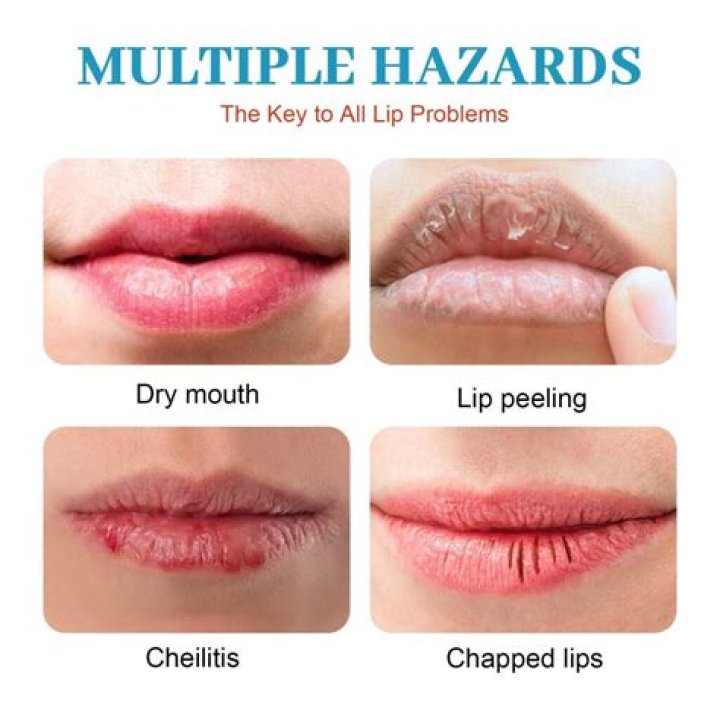 Can dehydration affect your lips?