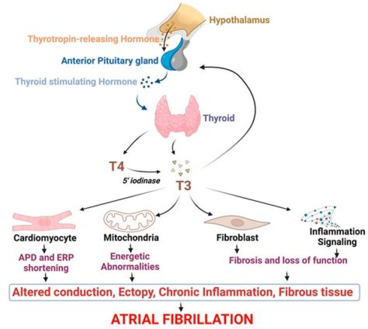 Can IV contrast cause thyroid storm?