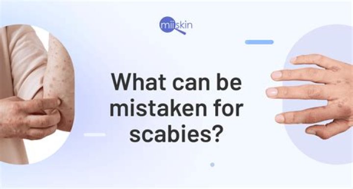 Can scabies cause bleeding?