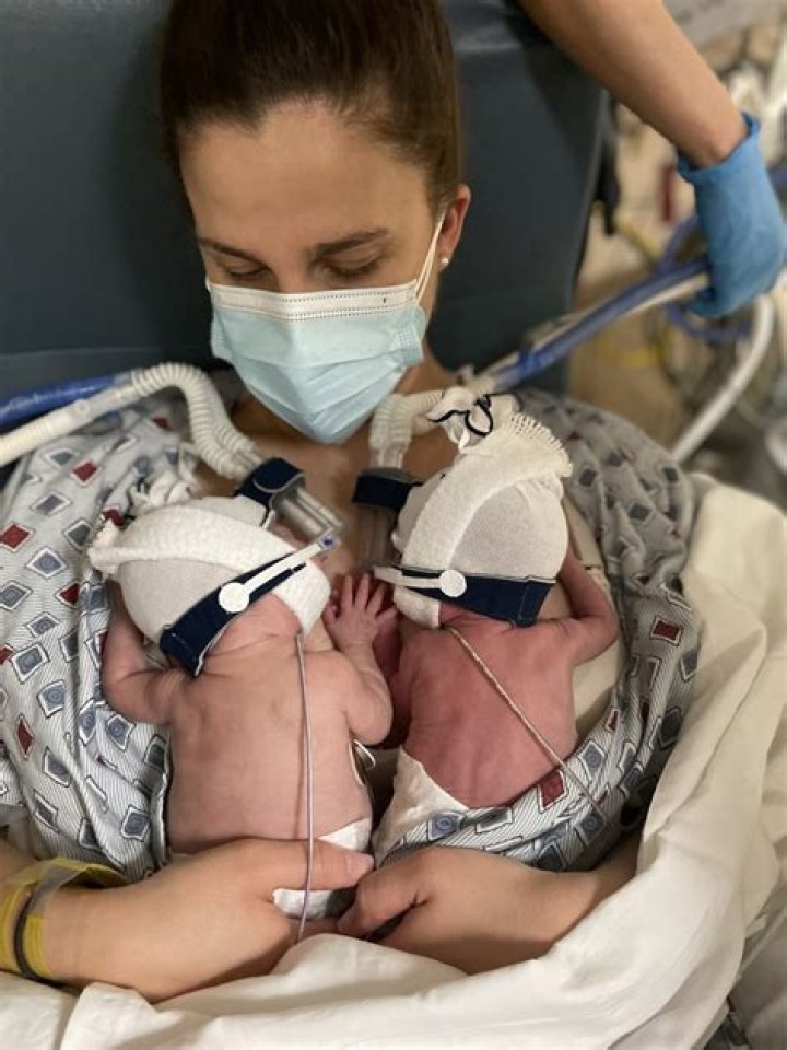 Can twins born at 24 weeks survive?