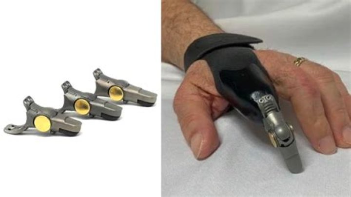 Can you get prosthetic fingers?