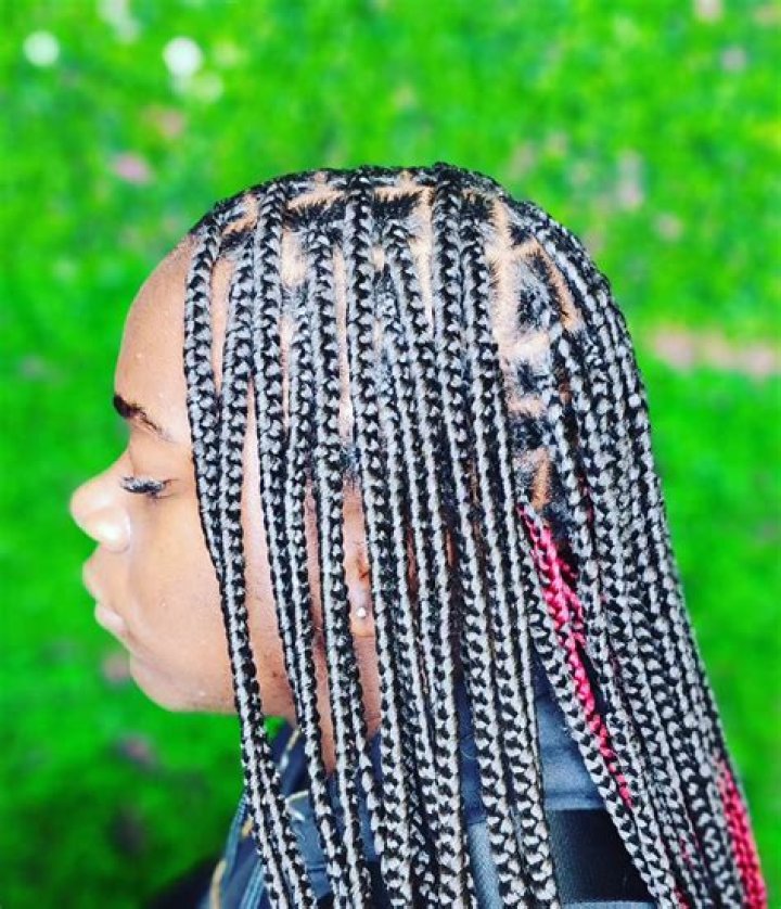 Can you go bald from box braids?
