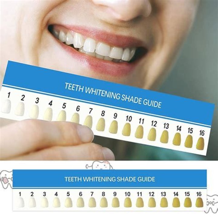 Do apples make teeth whiter?