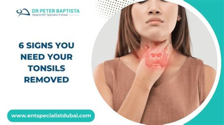 Do they take out the uvula when removing tonsils?