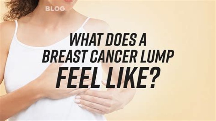 Does breast cancer feel like a grape?