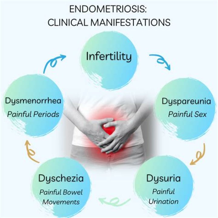 Does endometriosis cause bowel problems?