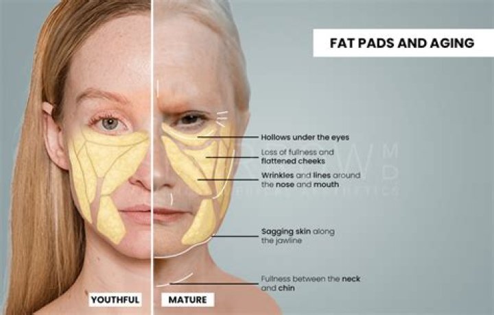 Does lower body fat change your face?