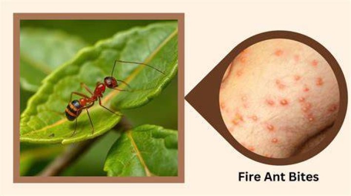 How do I treat fire ant bites on my dog?