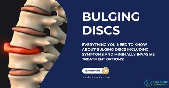 How do you fix a bulging lumbar disc?
