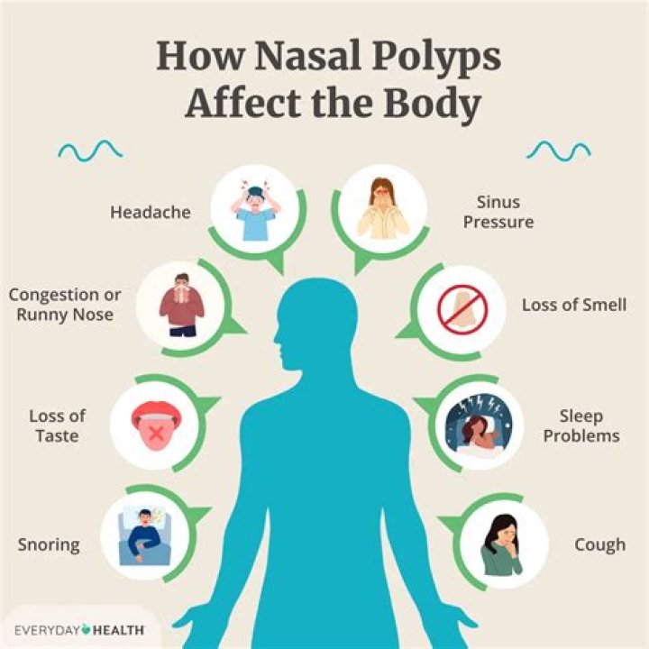 How do you know if you have nasal obstruction?