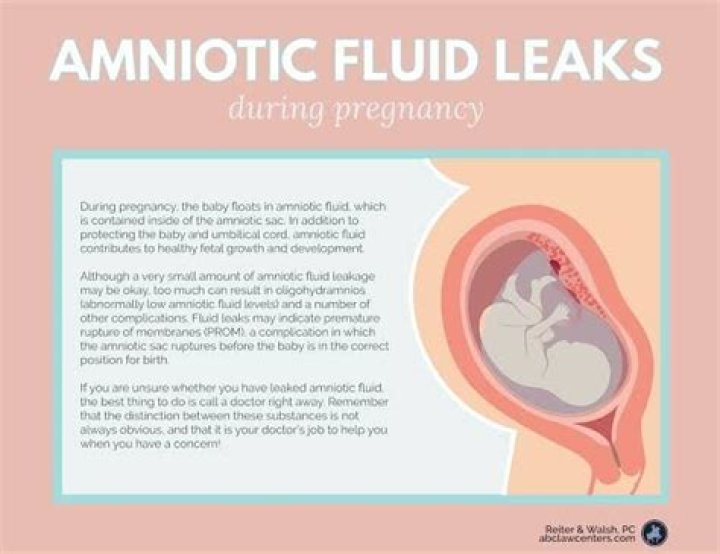 How do you know if your leaking amniotic fluid at 32 weeks?