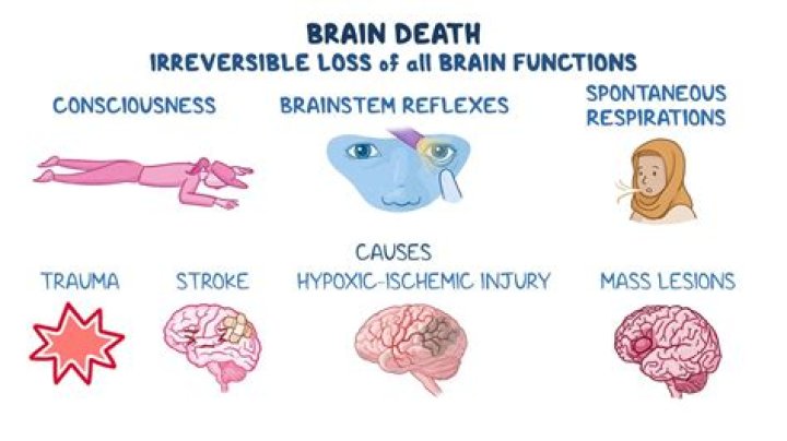 How do you test for brain death?