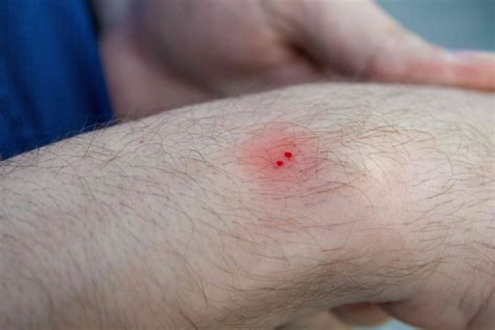 How does a snake bite looks like?