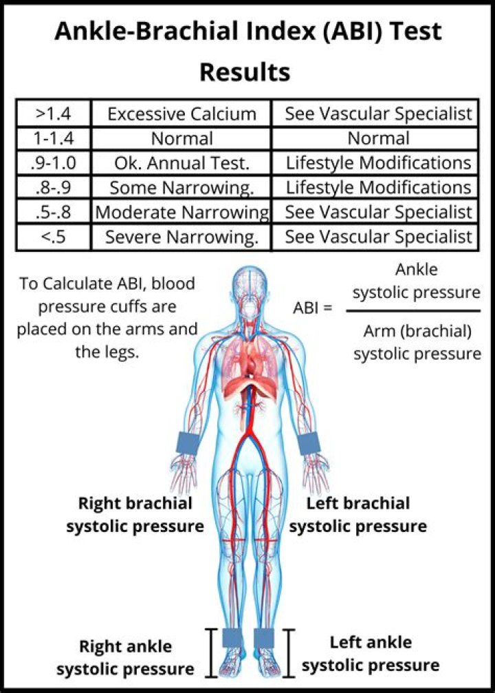 How is ABI test performed?