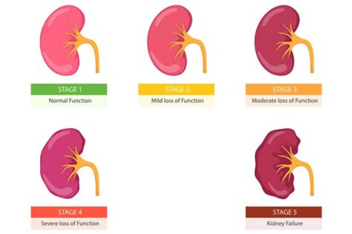 How is kidney failure treated with gout?
