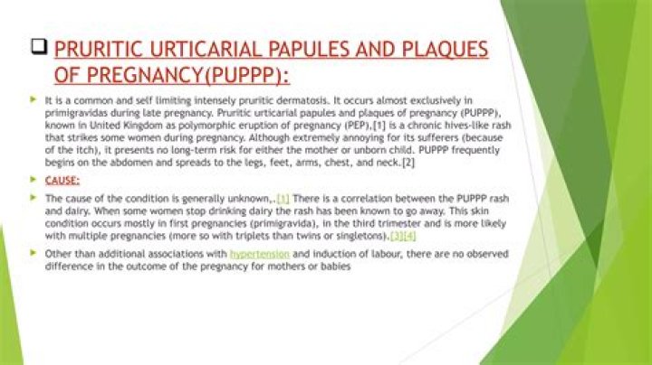 How is pruritic urticarial papules treated?