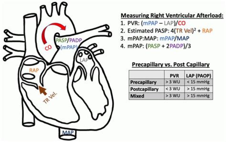 How is right ventricular afterload measured?