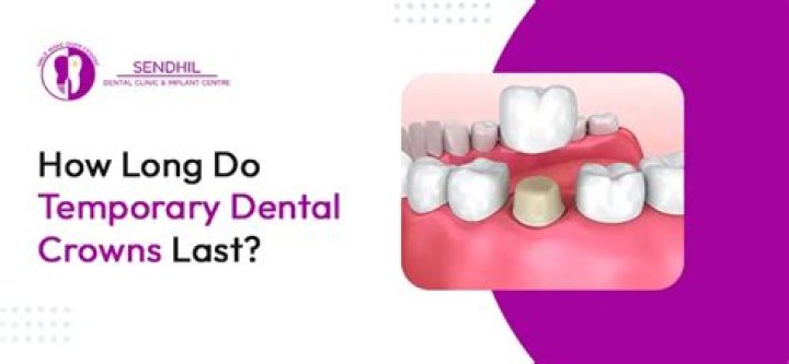 How long do temporary crowns last?