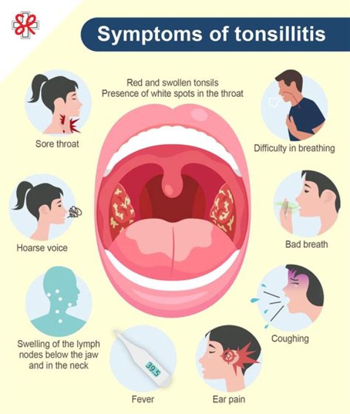 How long does viral tonsillitis last in babies?