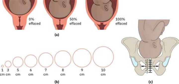 Is 2 cm dilated active labor?