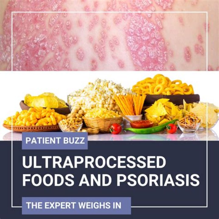 Is PUVA good for psoriasis?
