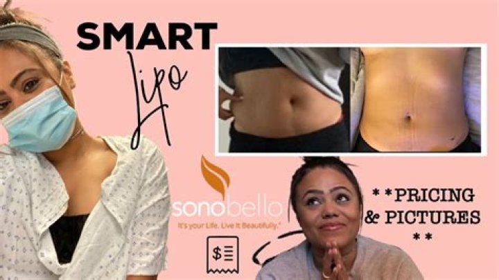 Is Smart Lipo the same as tumescent Lipo?