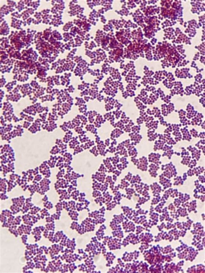 Is Staphylococcus aureus acid-fast positive or negative?