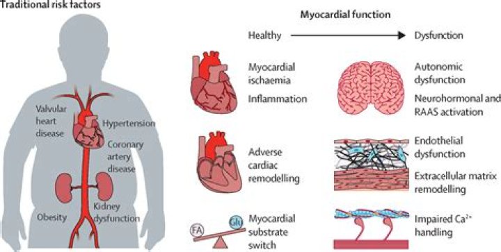 Is Type A personality linked to heart disease?