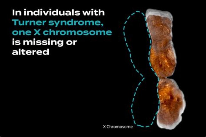 Is Windmill Syndrome Real?