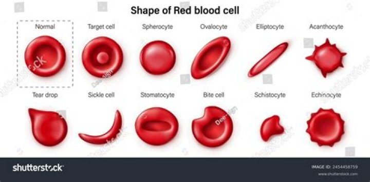 What are ovalocytes in the blood?