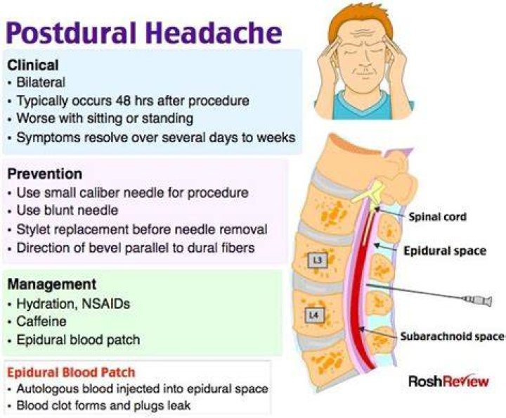 What causes a Postdural puncture headache?