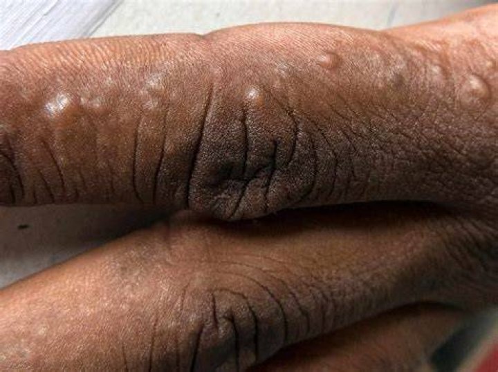 What causes itchy skin with black spots?