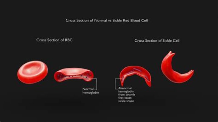 What causes odd shaped red blood cells?