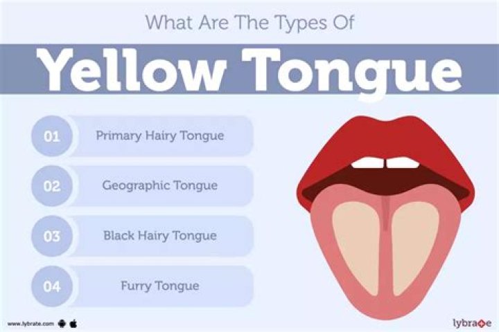 What does a yellow coated tongue mean?