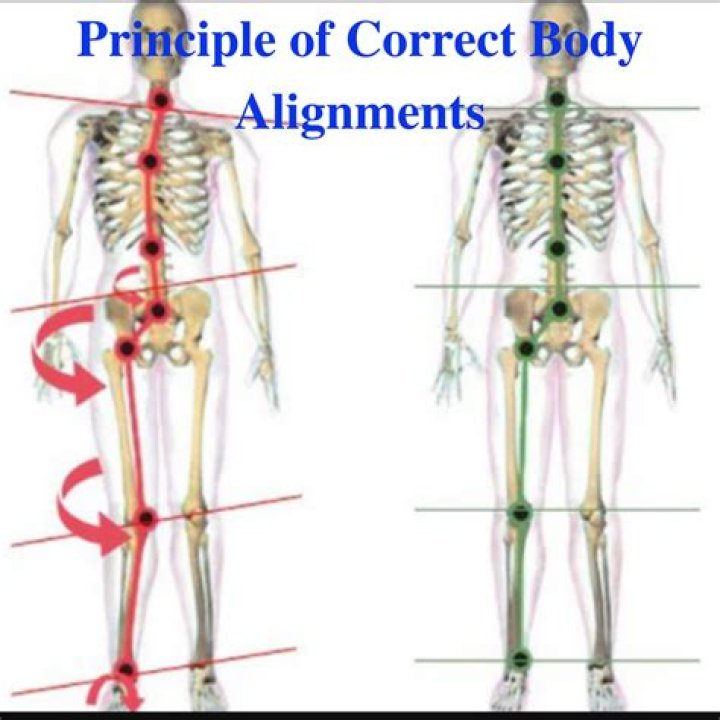 What does body alignment mean in medical terms?