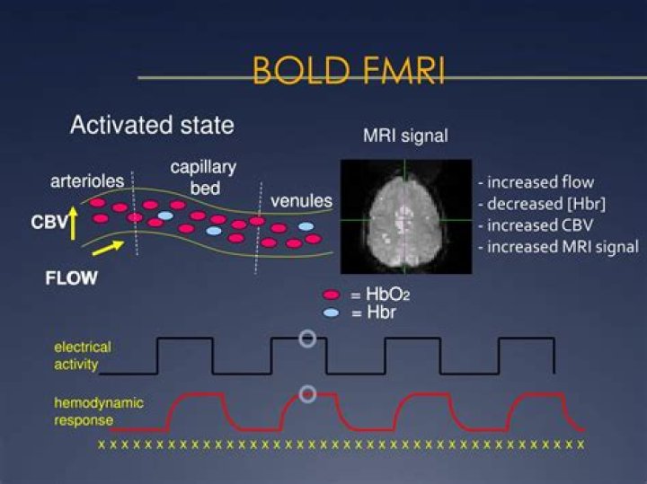 What does bold measure in fMRI?