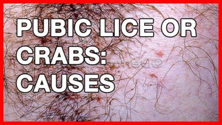 What does crabs look like on a male?