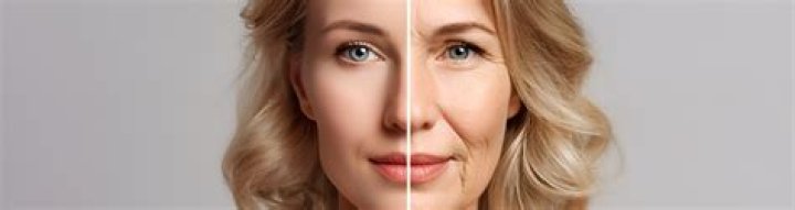 What does elastin do for the skin?