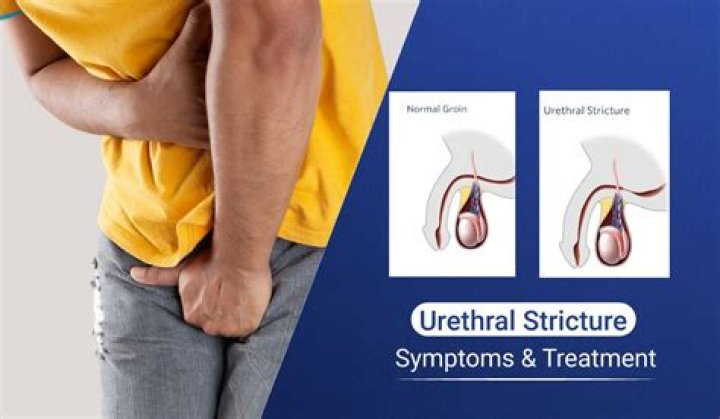 What does it mean if your urethra hurts men?