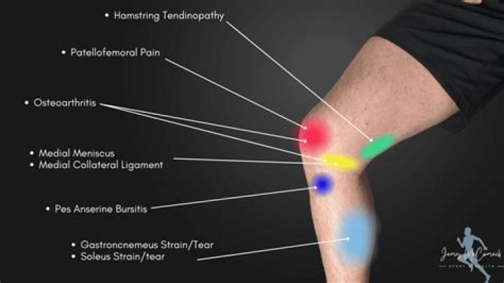 What does lateral knee pain indicate?