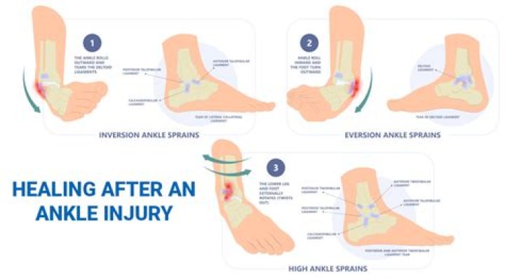 What helps ankle ligaments heal faster?