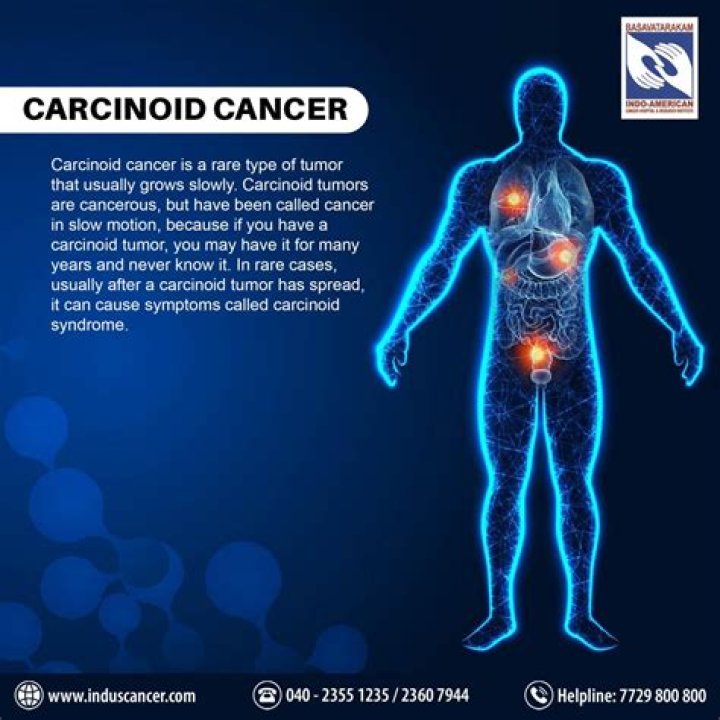 What is a carcinoid Tumorlet?