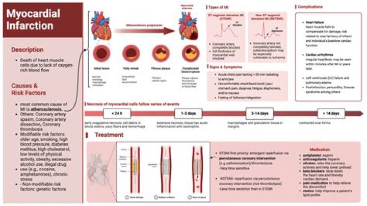 What is atherosclerosis acute myocardial infarction?