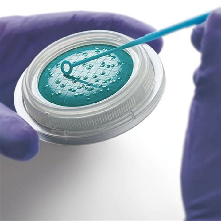 What is bioburden and endotoxin testing?