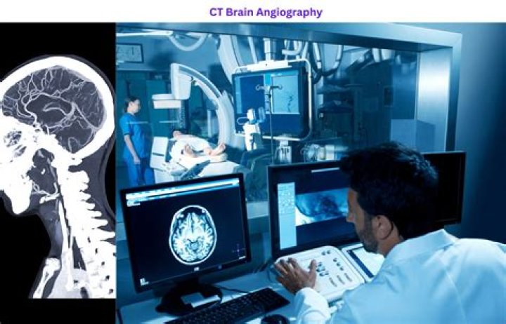 What is CT cerebral angiography?