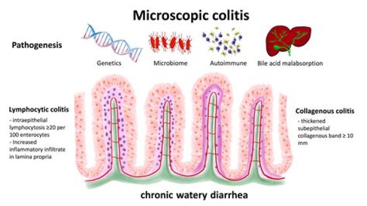 What is microscopic evaluation?