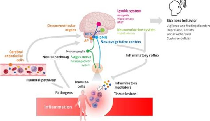 What is Neuro Immune Dysfunction Syndrome?