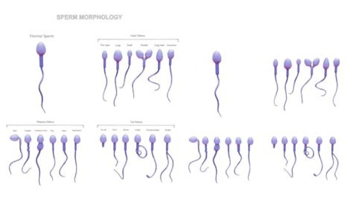 What is normal morphology percentage for sperm?