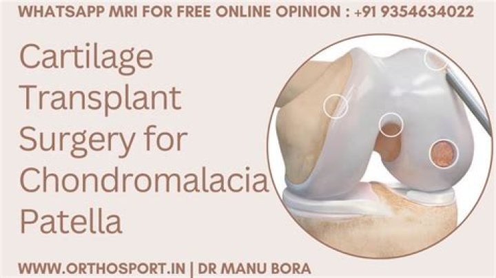 What is patellofemoral cartilage?